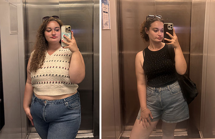 74 Wild Glow-Ups That Turned People’s Self-Doubt Into Confidence 74 Wild Glow-Ups That Turned People’s Self-Doubt Into Confidence