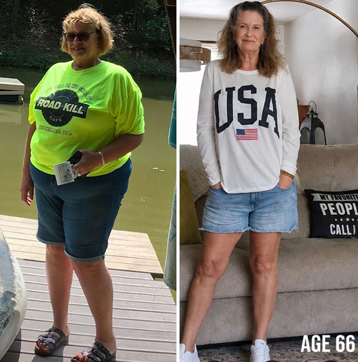 74 Wild Glow-Ups That Turned People’s Self-Doubt Into Confidence 74 Wild Glow-Ups That Turned People’s Self-Doubt Into Confidence