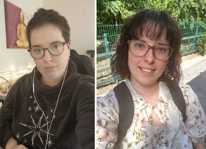 74 Wild Glow-Ups That Turned People’s Self-Doubt Into Confidence 74 Wild Glow-Ups That Turned People’s Self-Doubt Into Confidence