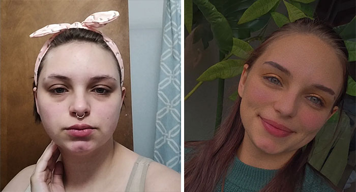 74 Wild Glow-Ups That Turned People’s Self-Doubt Into Confidence 74 Wild Glow-Ups That Turned People’s Self-Doubt Into Confidence