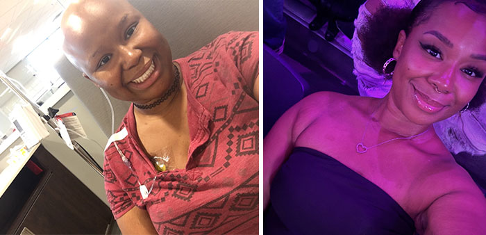 74 Wild Glow-Ups That Turned People’s Self-Doubt Into Confidence 74 Wild Glow-Ups That Turned People’s Self-Doubt Into Confidence