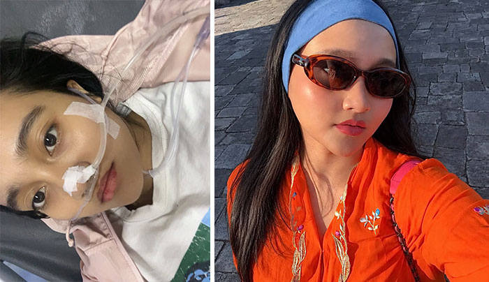 74 Wild Glow-Ups That Turned People’s Self-Doubt Into Confidence 74 Wild Glow-Ups That Turned People’s Self-Doubt Into Confidence