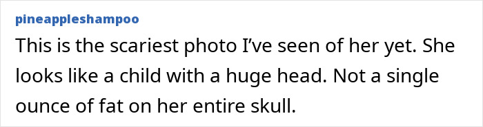 “Scariest Photo I’ve Seen Of Her Yet”: New Ariana Grande Snaps Spur Worry As People Note Concerning Detail “Scariest Photo I’ve Seen Of Her Yet”: New Ariana Grande Snaps Spur Worry As People Note Concerning Detail