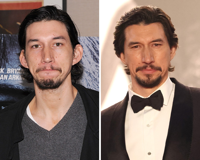 Adam Driver Sparks Frenzy Over Plastic Surgery Speculation After Netizens Notice Strange Detail In Viral Photos Adam Driver Sparks Frenzy Over Plastic Surgery Speculation After Netizens Notice Strange Detail In Viral Photos