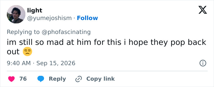 Adam Driver Sparks Frenzy Over Plastic Surgery Speculation After Netizens Notice Strange Detail In Viral Photos Adam Driver Sparks Frenzy Over Plastic Surgery Speculation After Netizens Notice Strange Detail In Viral Photos