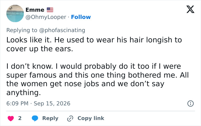 Adam Driver Sparks Frenzy Over Plastic Surgery Speculation After Netizens Notice Strange Detail In Viral Photos Adam Driver Sparks Frenzy Over Plastic Surgery Speculation After Netizens Notice Strange Detail In Viral Photos