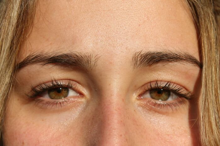 Woman Thinks Her Blurry Vision Is Just A Hangover, Ends Up Losing Her Eye After Doctors Find A Tumor Woman Thinks Her Blurry Vision Is Just A Hangover, Ends Up Losing Her Eye After Doctors Find A Tumor