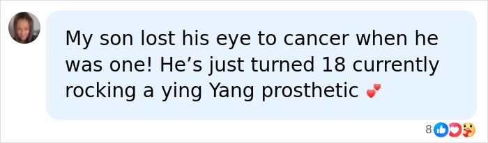 Woman Thinks Her Blurry Vision Is Just A Hangover, Ends Up Losing Her Eye After Doctors Find A Tumor Woman Thinks Her Blurry Vision Is Just A Hangover, Ends Up Losing Her Eye After Doctors Find A Tumor