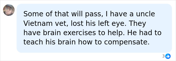 Woman Thinks Her Blurry Vision Is Just A Hangover, Ends Up Losing Her Eye After Doctors Find A Tumor Woman Thinks Her Blurry Vision Is Just A Hangover, Ends Up Losing Her Eye After Doctors Find A Tumor