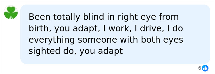 Woman Thinks Her Blurry Vision Is Just A Hangover, Ends Up Losing Her Eye After Doctors Find A Tumor Woman Thinks Her Blurry Vision Is Just A Hangover, Ends Up Losing Her Eye After Doctors Find A Tumor