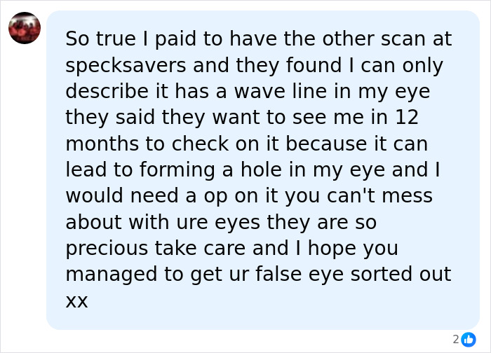 Woman Thinks Her Blurry Vision Is Just A Hangover, Ends Up Losing Her Eye After Doctors Find A Tumor Woman Thinks Her Blurry Vision Is Just A Hangover, Ends Up Losing Her Eye After Doctors Find A Tumor