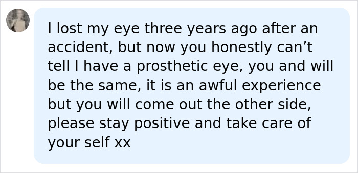 Woman Thinks Her Blurry Vision Is Just A Hangover, Ends Up Losing Her Eye After Doctors Find A Tumor Woman Thinks Her Blurry Vision Is Just A Hangover, Ends Up Losing Her Eye After Doctors Find A Tumor