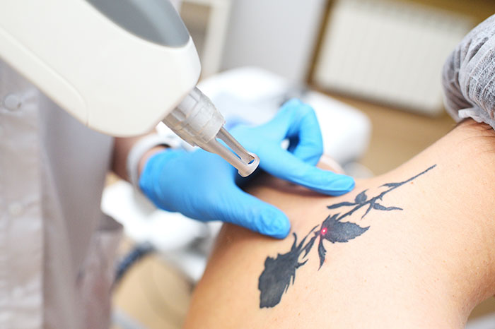 19YO Gets &ldquo;DEVAST8&rdquo; Tattooed Across His Face, Then A New Job Changes His Plans For The Tattoo