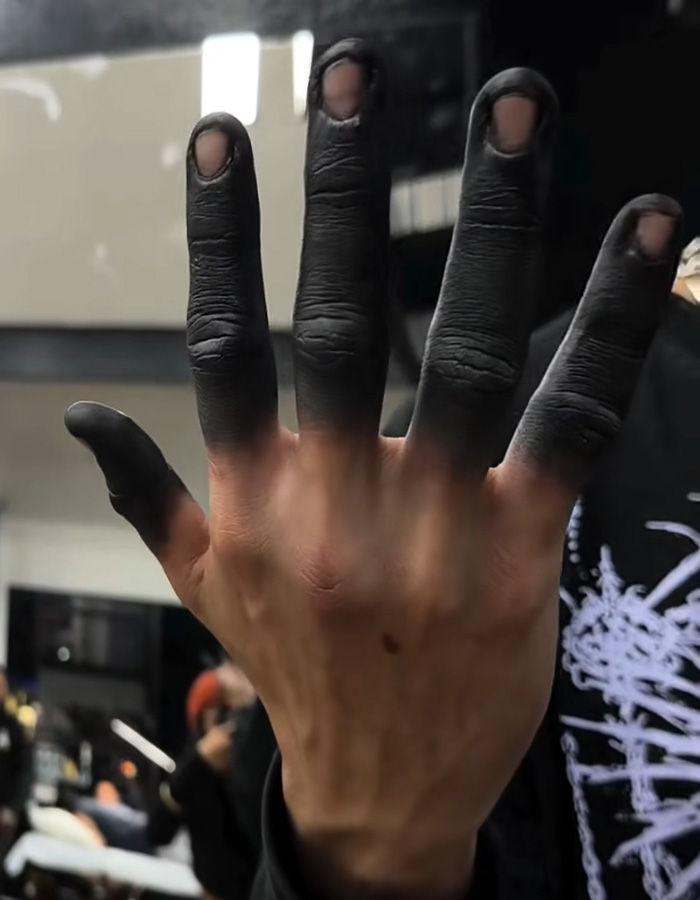 Viral Fingertip Tattoo Trend Hit With Chilling Warnings From Doctors Over The Risks Involved