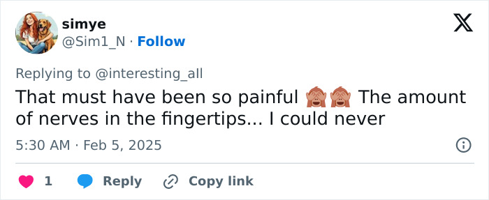 Viral Fingertip Tattoo Trend Hit With Chilling Warnings From Doctors Over The Risks Involved