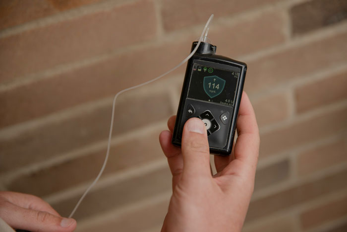 Entitled Mom Demands Guy’s Medical Device Because Her Spoiled Teen Is Bored