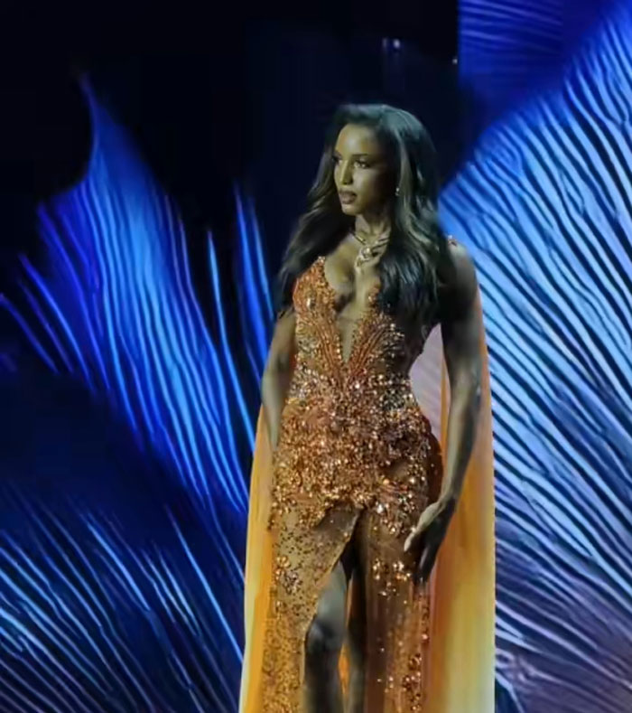 Miss Universe Jamaica Gabrielle Henry Breaks Her Silence On The Fall That “Permanently Altered” Her Life Miss Universe Jamaica Gabrielle Henry Breaks Her Silence On The Fall That “Permanently Altered” Her Life