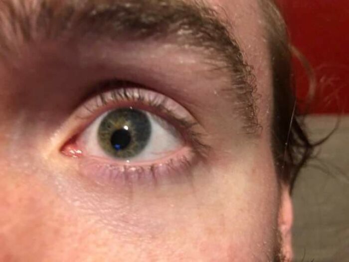 75 People With Physical Features So Rare They Almost Don&rsquo;t Look Real