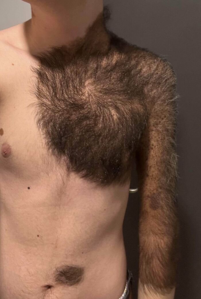 75 People With Physical Features So Rare They Almost Don&rsquo;t Look Real