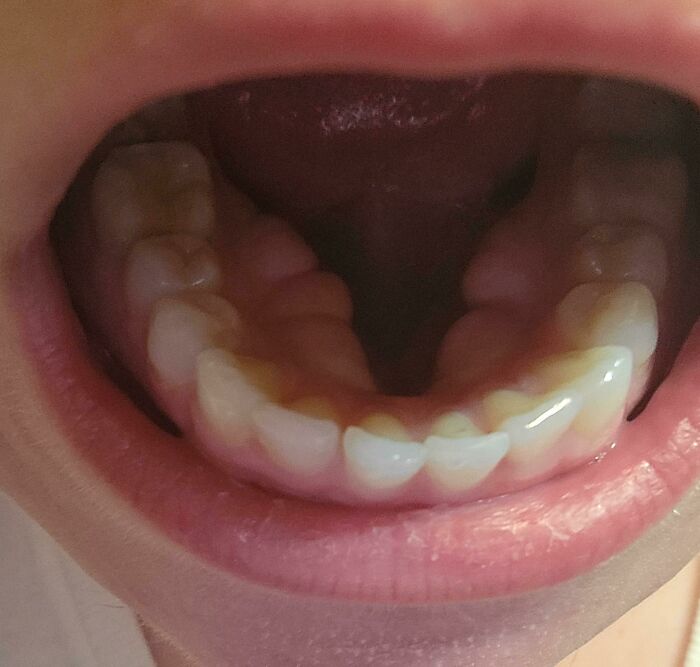 75 People With Physical Features So Rare They Almost Don&rsquo;t Look Real