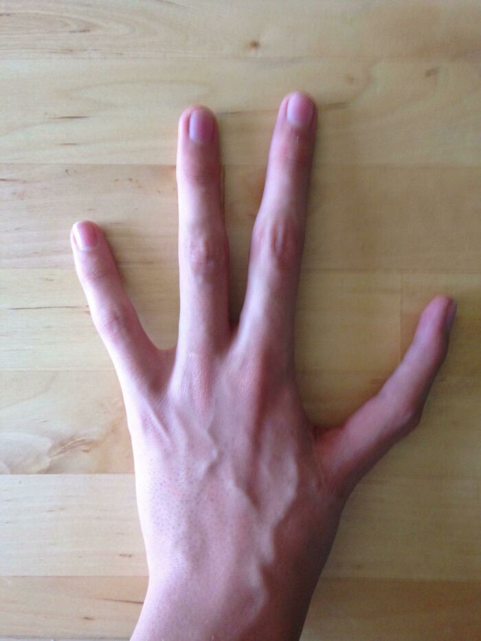 75 People With Physical Features So Rare They Almost Don&rsquo;t Look Real