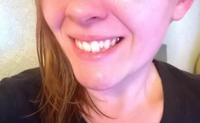 75 People With Physical Features So Rare They Almost Don&rsquo;t Look Real
