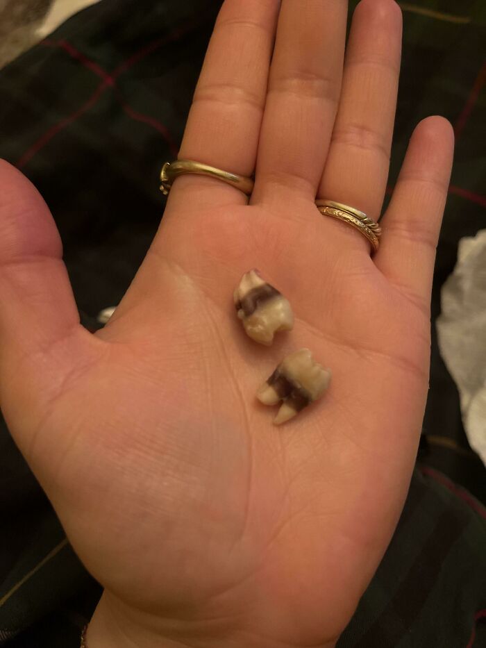 75 People With Physical Features So Rare They Almost Don&rsquo;t Look Real