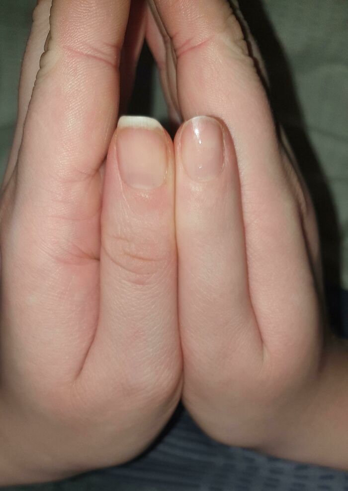 75 People With Physical Features So Rare They Almost Don&rsquo;t Look Real