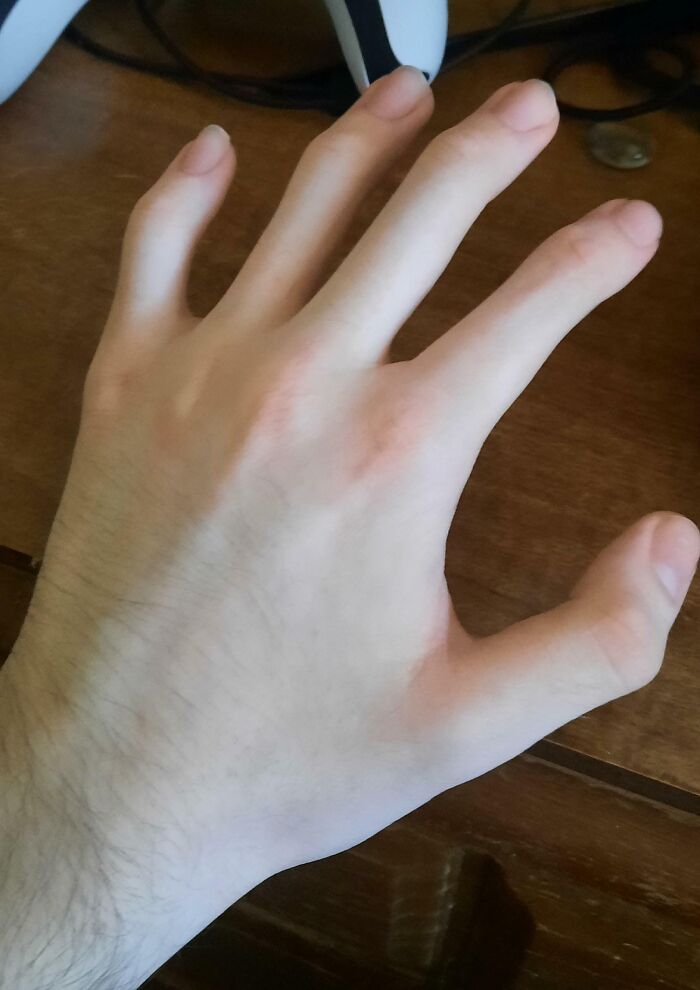 75 People With Physical Features So Rare They Almost Don&rsquo;t Look Real