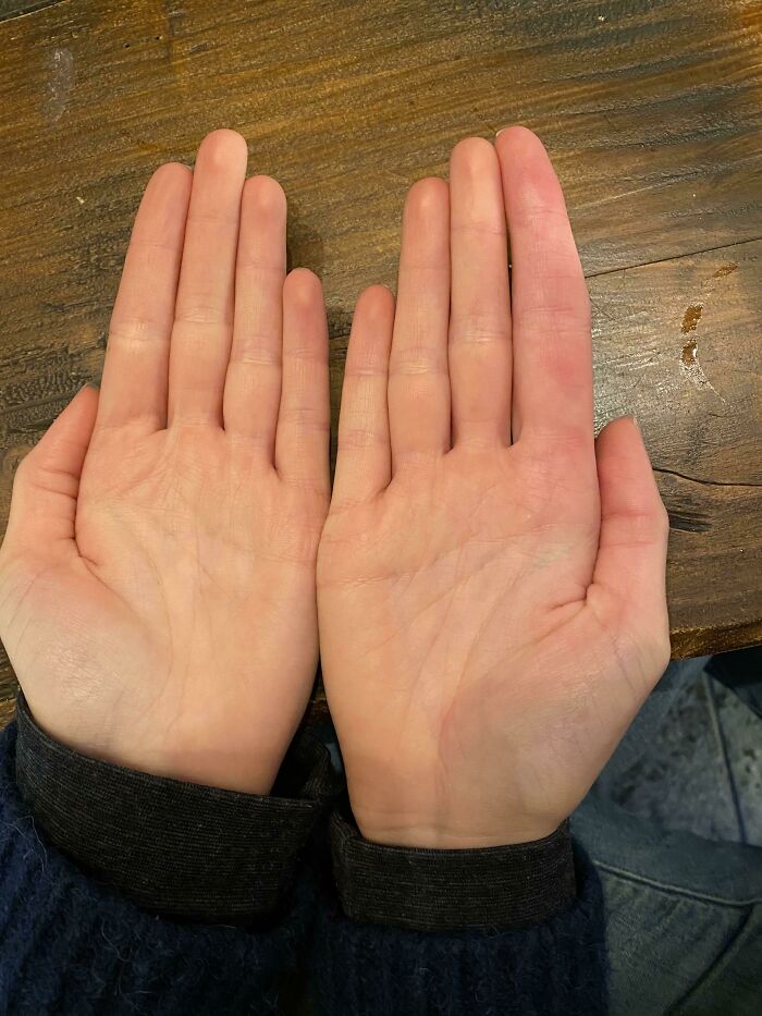 75 People With Physical Features So Rare They Almost Don&rsquo;t Look Real