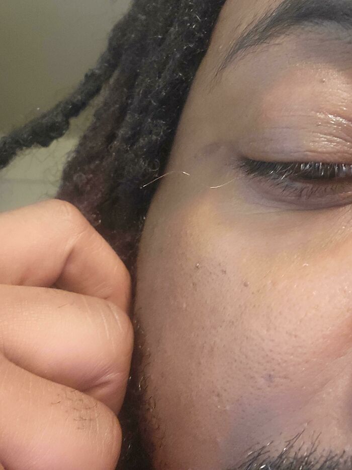 75 People With Physical Features So Rare They Almost Don&rsquo;t Look Real