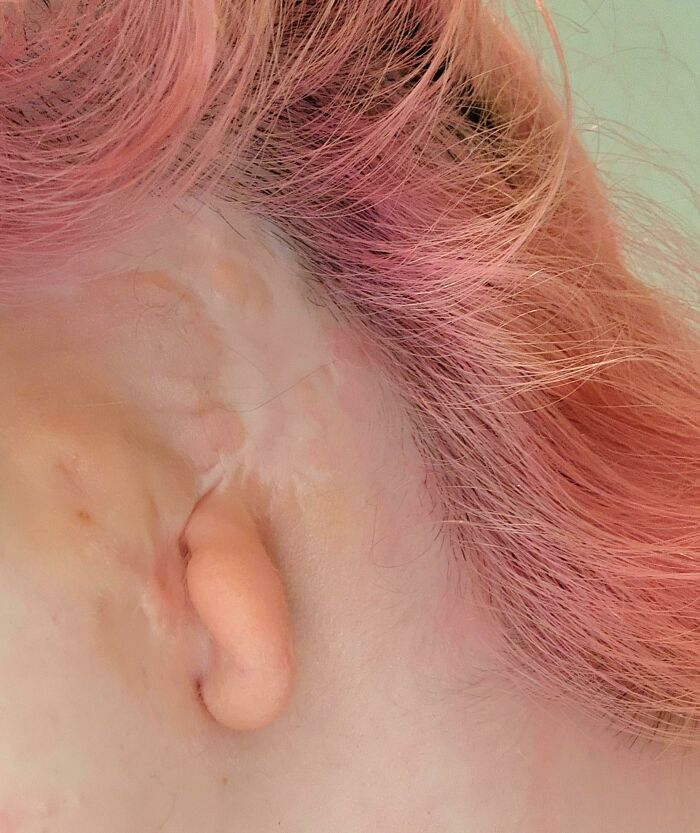 75 People With Physical Features So Rare They Almost Don&rsquo;t Look Real