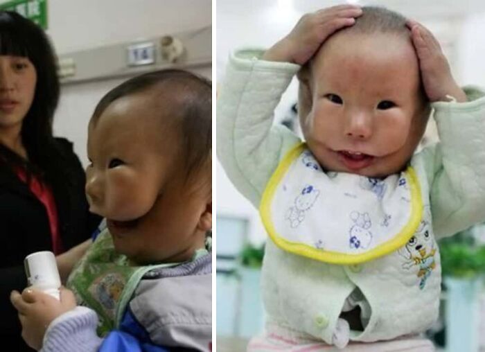 75 People With Physical Features So Rare They Almost Don&rsquo;t Look Real