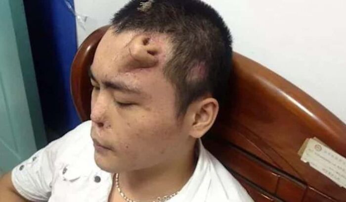 75 People With Physical Features So Rare They Almost Don&rsquo;t Look Real