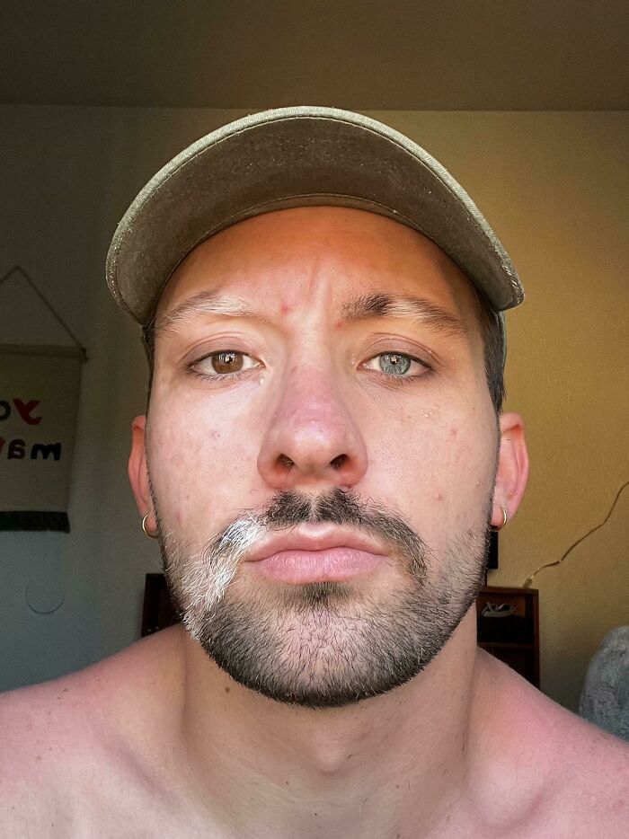 75 People With Physical Features So Rare They Almost Don&rsquo;t Look Real