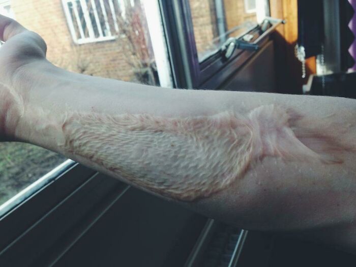 75 People With Physical Features So Rare They Almost Don&rsquo;t Look Real