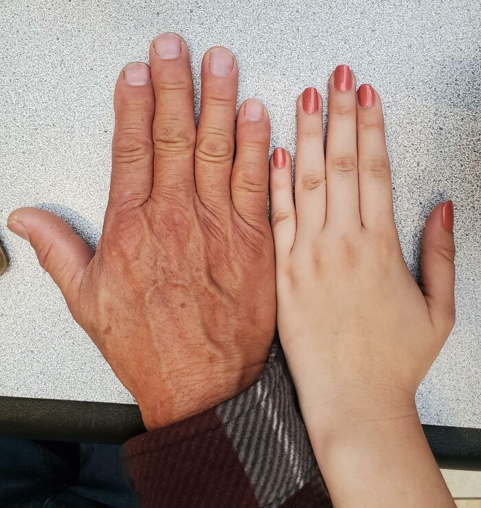75 People With Physical Features So Rare They Almost Don&rsquo;t Look Real