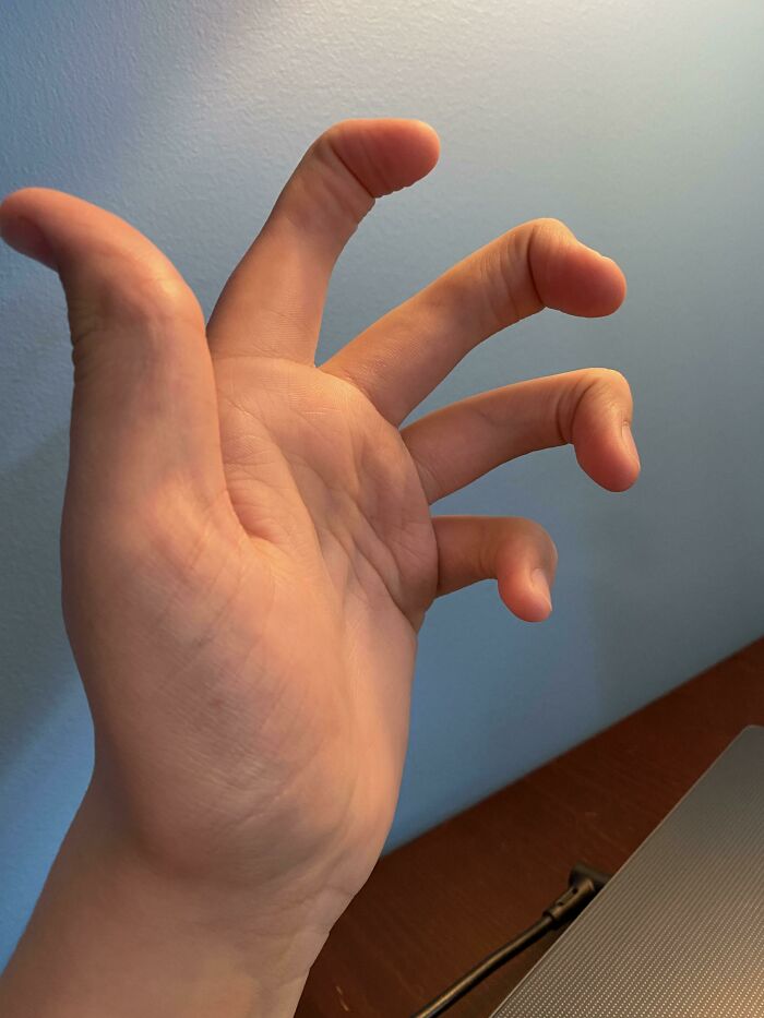 75 People With Physical Features So Rare They Almost Don&rsquo;t Look Real