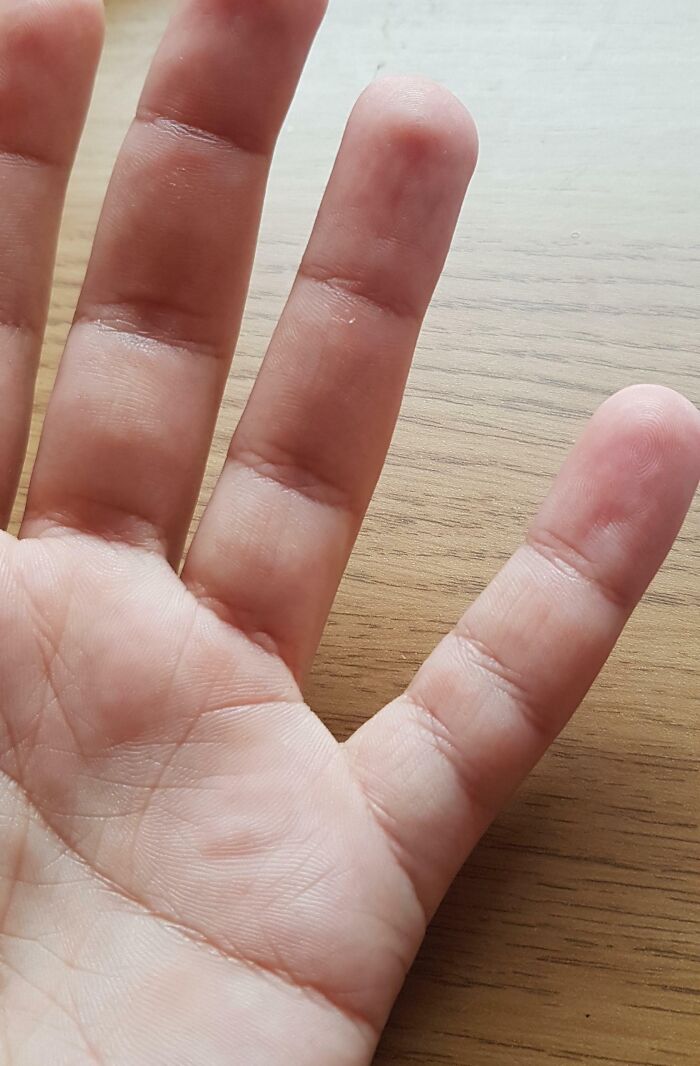 75 People With Physical Features So Rare They Almost Don&rsquo;t Look Real