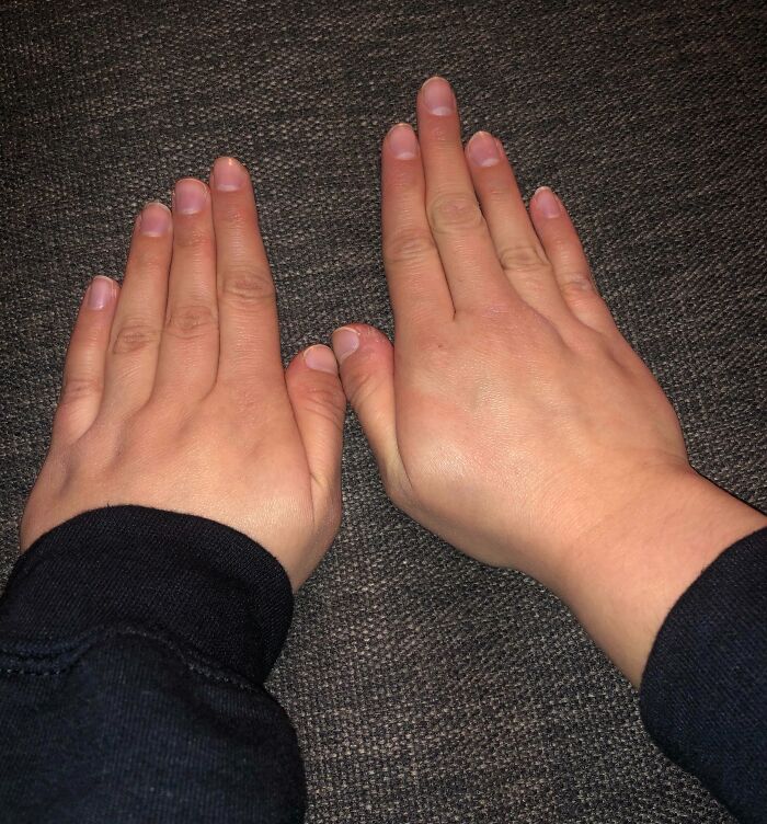 75 People With Physical Features So Rare They Almost Don&rsquo;t Look Real