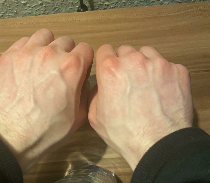 75 People With Physical Features So Rare They Almost Don&rsquo;t Look Real
