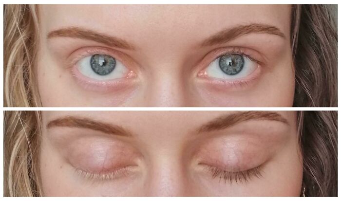 75 People With Physical Features So Rare They Almost Don&rsquo;t Look Real