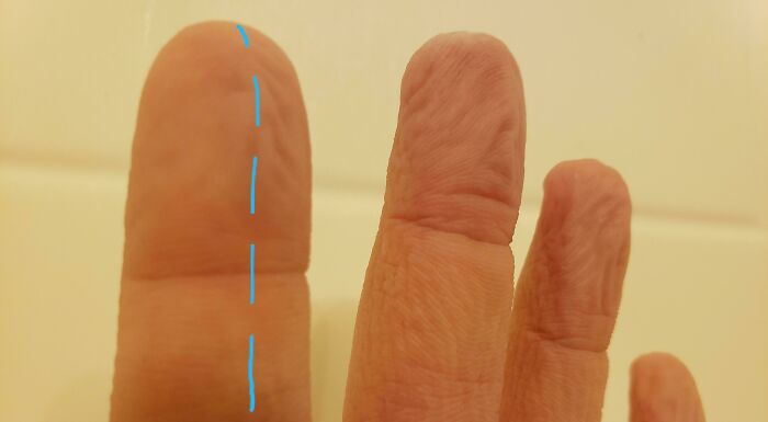 75 People With Physical Features So Rare They Almost Don&rsquo;t Look Real