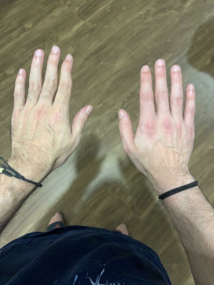 75 People With Physical Features So Rare They Almost Don&rsquo;t Look Real