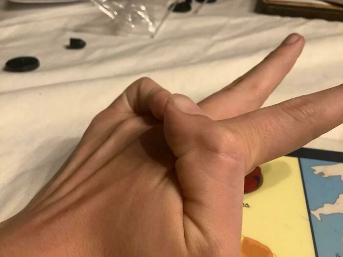 75 People With Physical Features So Rare They Almost Don&rsquo;t Look Real