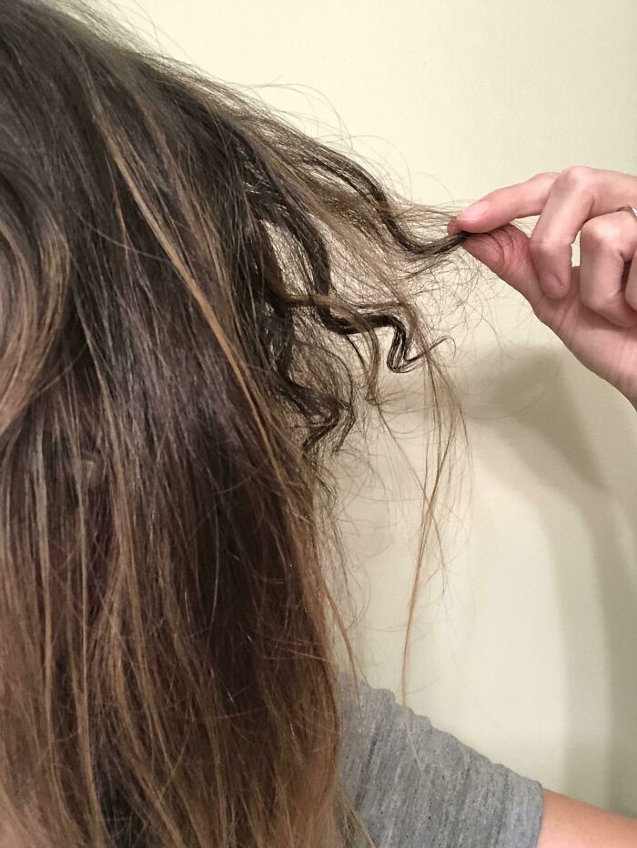 75 People With Physical Features So Rare They Almost Don&rsquo;t Look Real