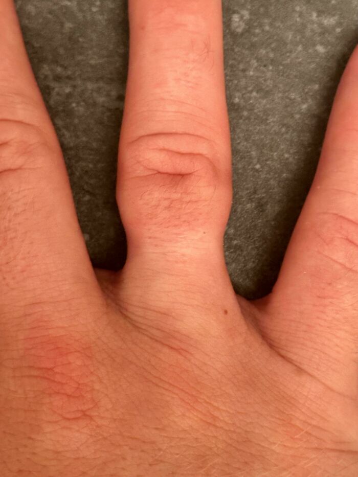 75 People With Physical Features So Rare They Almost Don&rsquo;t Look Real
