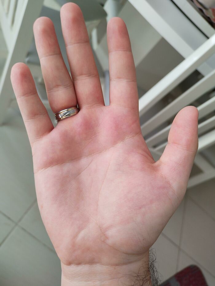 75 People With Physical Features So Rare They Almost Don&rsquo;t Look Real