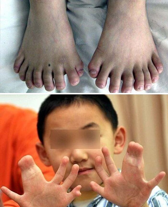 75 People With Physical Features So Rare They Almost Don&rsquo;t Look Real