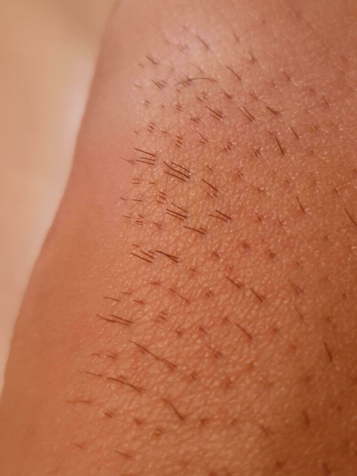 75 People With Physical Features So Rare They Almost Don&rsquo;t Look Real